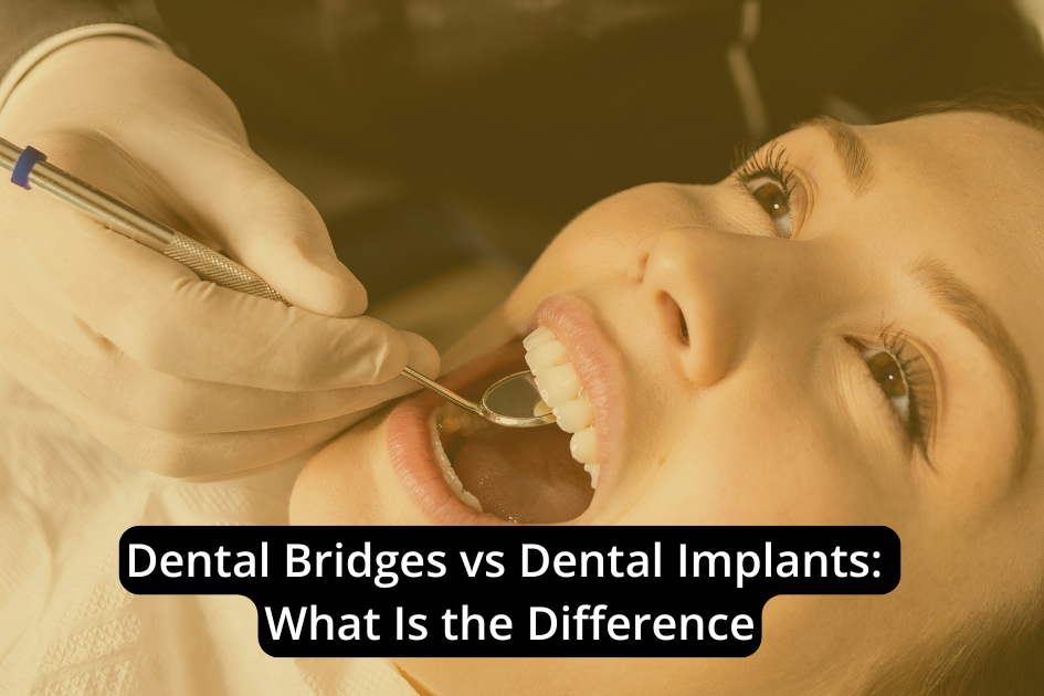 A dentist examines a patient's open mouth with a dental mirror; text overlay reads, "Difference Between Dental Bridges and Dental Implants: What You Need to Know.